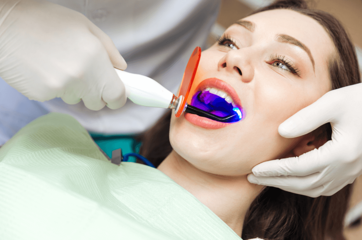 dental laser cleaning